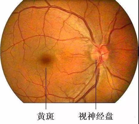 黄斑变性-中南大学湘雅三医院健康管理中心